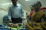 Doctors Suspect Rare Disease Might Have Afflicted Indian Child