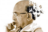 High blood pressure raises risk of developing vascular dementia High blood pressure raises risk of developing vascular dementia