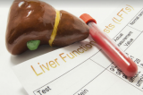 Health Alert: 6 rare diseases you must know about Health Alert: 6 rare diseases you must know about