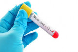 Nipah Virus: Everything about the virus that’s taking lives in Kerala! Nipah Virus: Everything about the virus that’s taking lives in Kerala!