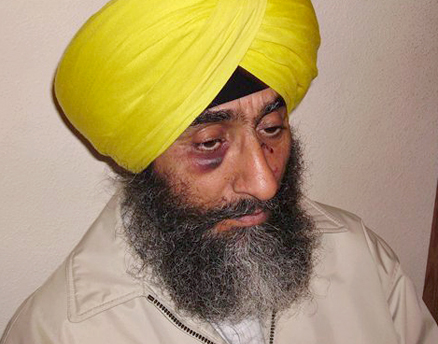 Seattle, Wash.-area taxi driver Kashmira Hothi was severely beaten by his passenger Jamie Larson, who uttered racial epithets during the attack. Larson was sentenced to 40 months in prison for committing a hate crime.